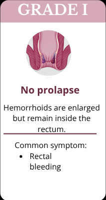 Grade-1-Hemorrhoids