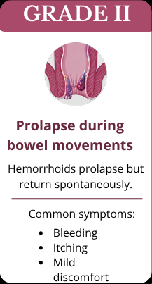 Grade-2-Hemorrhoids