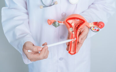 Uterine Fibroid Embolization (UFE)